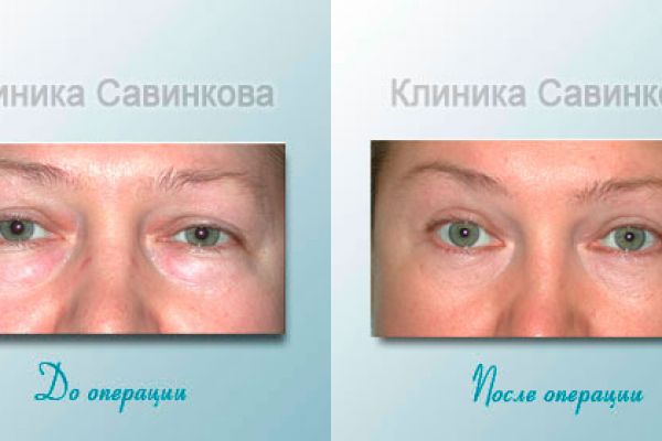 example-9992ED6E49E-12BF-70F3-D0C5-D76E4BF69728.jpg