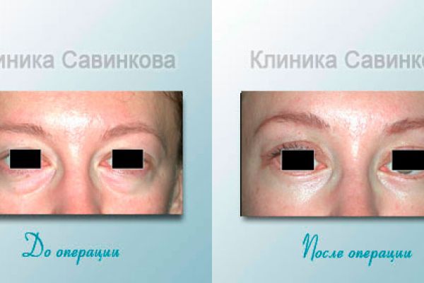 example-9999142A875D-5BDD-F97C-22A5-7D8CF29E28EF.jpg